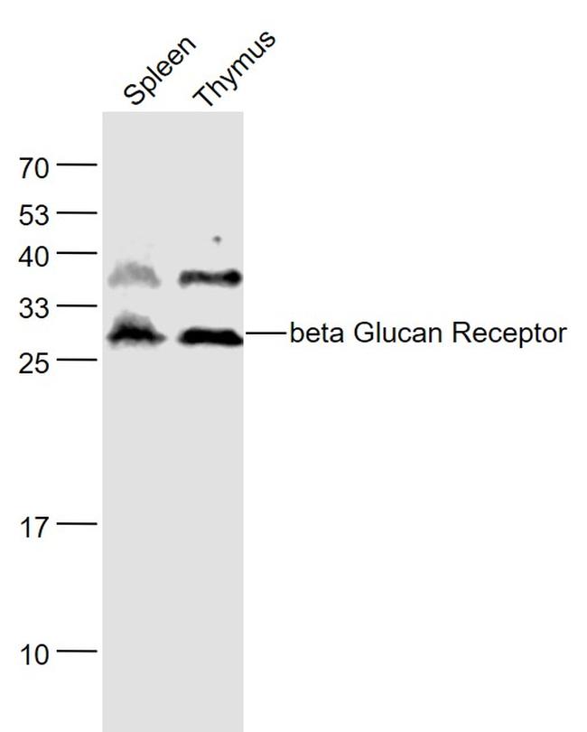 beta Glucan Receptor Antibody in Western Blot (WB)