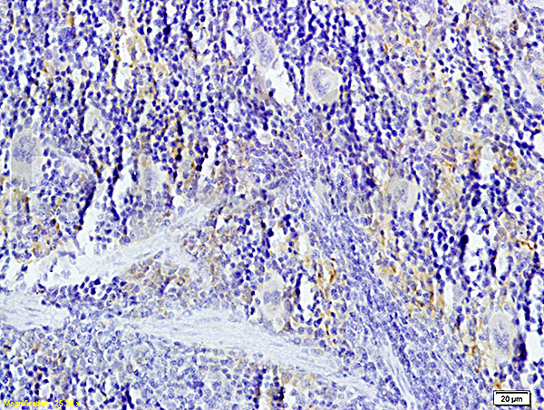 TNFSF14 Antibody in Immunohistochemistry (Paraffin) (IHC (P))