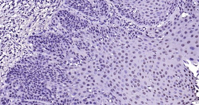 Histone H3 (acetyl K4) Antibody in Immunohistochemistry (Paraffin) (IHC (P))