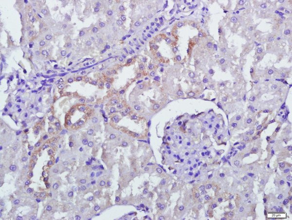 PERK Antibody in Immunohistochemistry (Paraffin) (IHC (P))