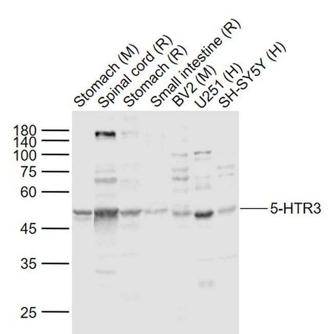 5-HTR3 Antibody in Western Blot (WB)