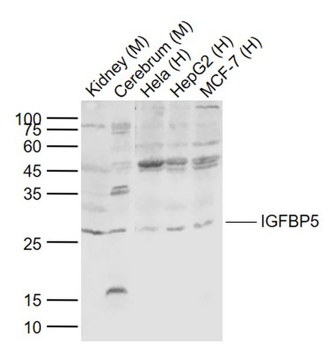 IGFBP5 Antibody in Western Blot (WB)