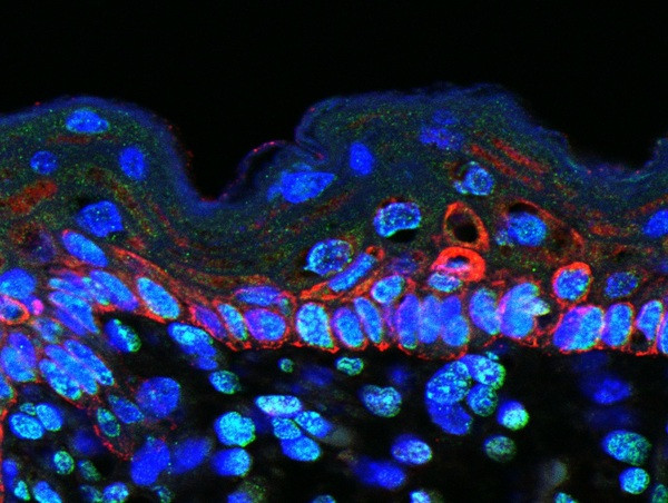 Macrophage Inflammatory Protein 1 gamma Antibody in Immunohistochemistry (Paraffin) (IHC (P))