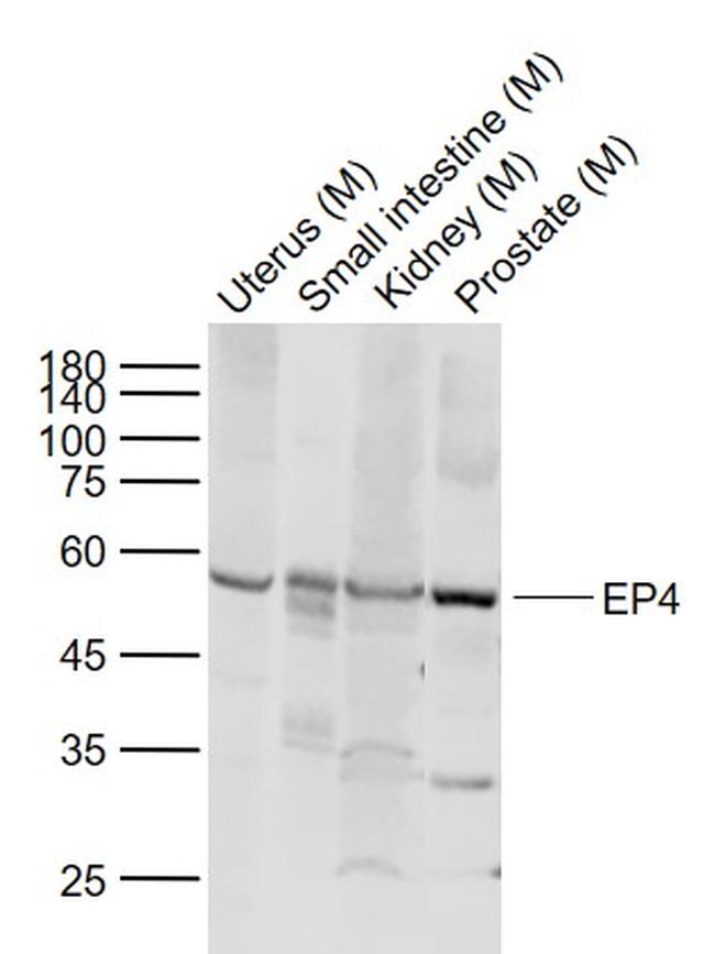 ProsTaglandin E Receptor EP4 Antibody in Western Blot (WB)