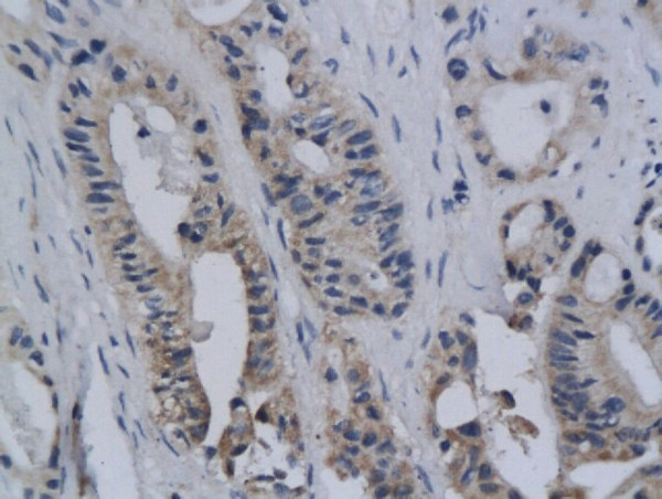 c-Ros Antibody in Immunohistochemistry (Paraffin) (IHC (P))