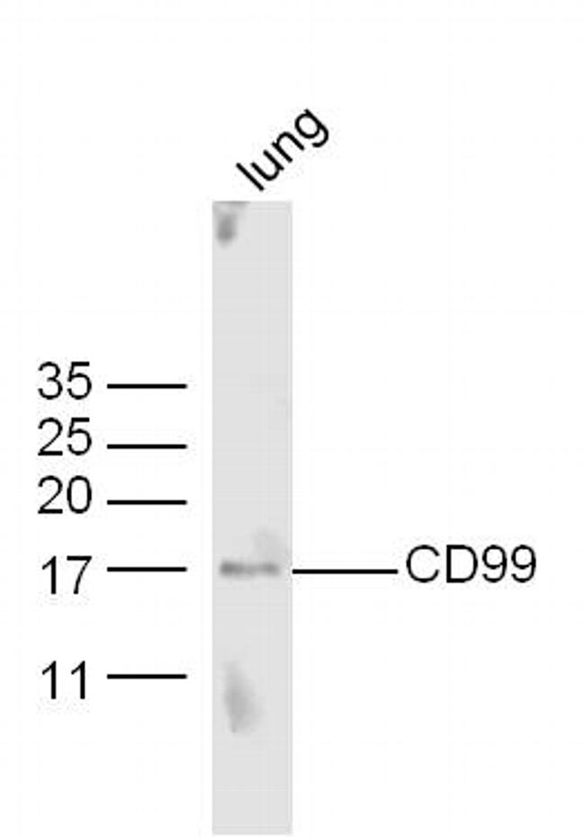 CD99 Antibody in Western Blot (WB)