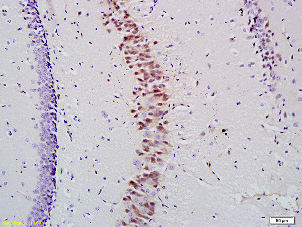 NES1/KLK10 Antibody in Immunohistochemistry (Paraffin) (IHC (P))