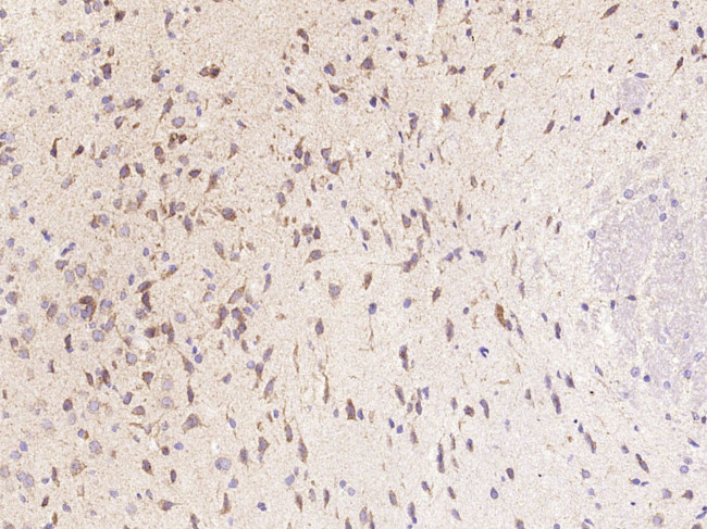 CXCL5 Antibody in Immunohistochemistry (Paraffin) (IHC (P))