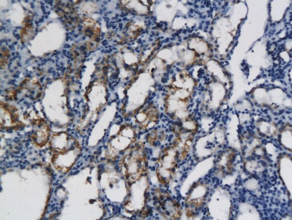 CXCL11 Antibody in Immunohistochemistry (Paraffin) (IHC (P))