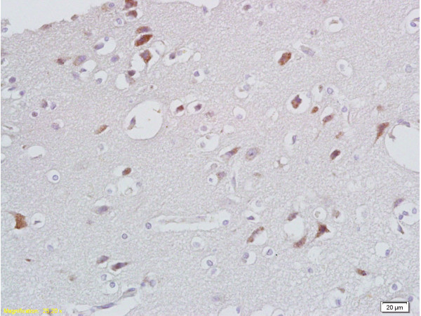 CXCL13/BCA1 Antibody in Immunohistochemistry (Paraffin) (IHC (P))