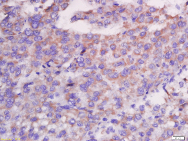 CXCL13/BCA1 Antibody in Immunohistochemistry (Paraffin) (IHC (P))