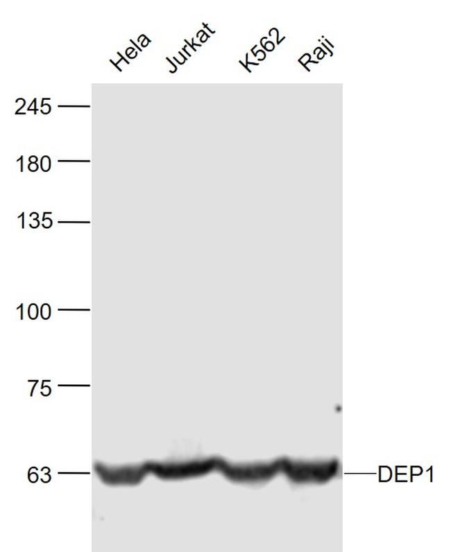 DEP1/PTPRJ Antibody in Western Blot (WB)