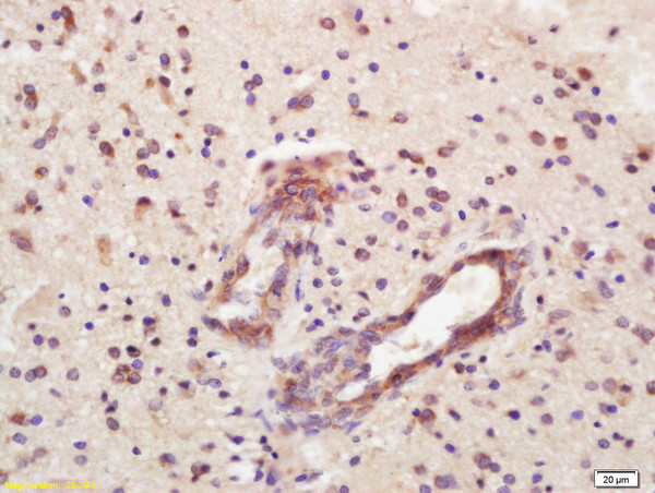 CD32 Antibody in Immunohistochemistry (Paraffin) (IHC (P))