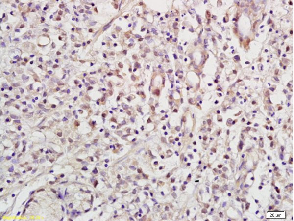 NRSF/REST Antibody in Immunohistochemistry (Paraffin) (IHC (P))