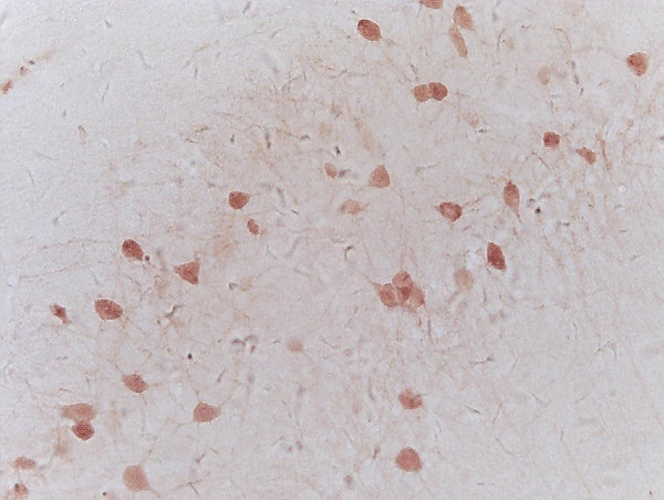 NRSF/REST Antibody in Immunohistochemistry (Paraffin) (IHC (P))