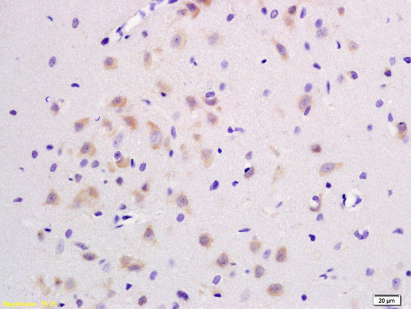 JNK1+2+3 Antibody in Immunohistochemistry (Paraffin) (IHC (P))