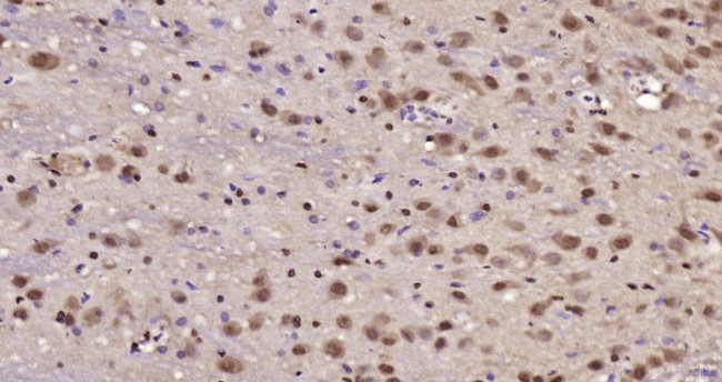 JNK1+2+3 Antibody in Immunohistochemistry (Paraffin) (IHC (P))