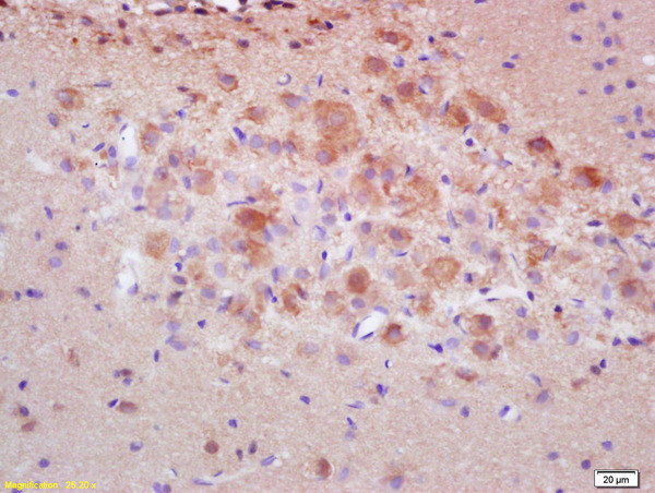 Caspase 3 Antibody in Immunohistochemistry (Paraffin) (IHC (P))