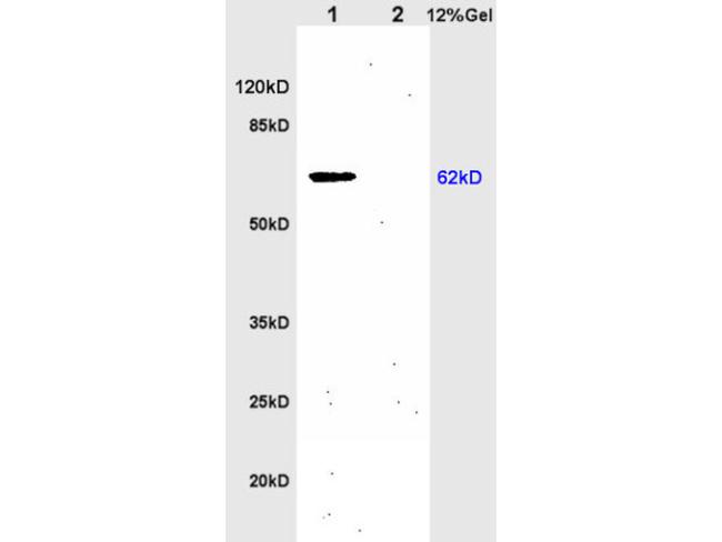 IL-1R1 Antibody in Western Blot (WB)