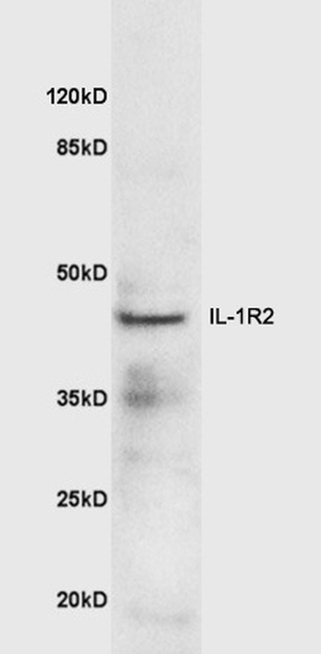 IL-1R2 Antibody in Western Blot (WB)