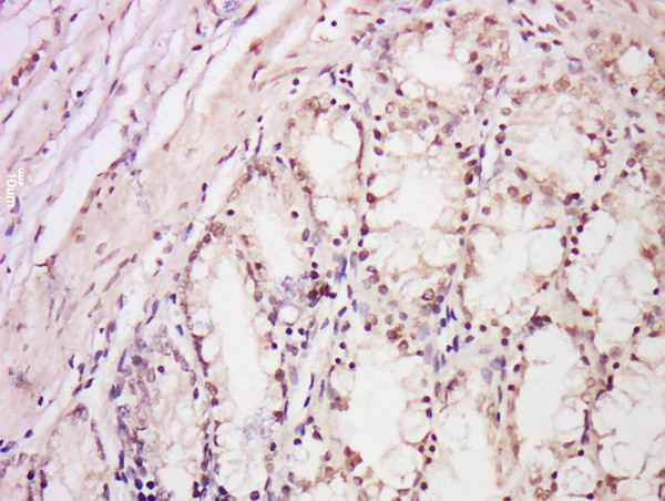 DDB2 Antibody in Immunohistochemistry (Paraffin) (IHC (P))