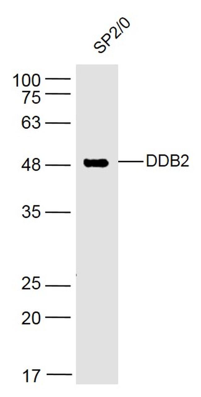 DDB2 Antibody in Western Blot (WB)