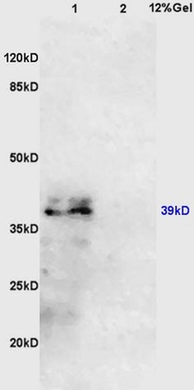 IL10RB Antibody in Western Blot (WB)