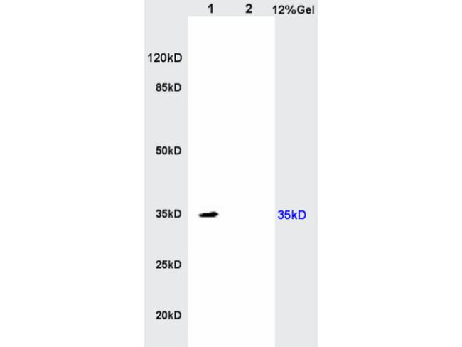 IL-17RB Antibody in Western Blot (WB)