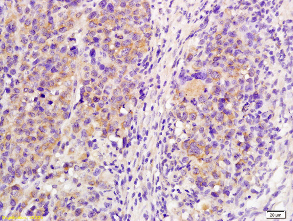 IL-21R Antibody in Immunohistochemistry (Paraffin) (IHC (P))