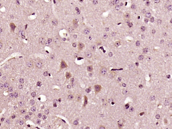 IL-22 Antibody in Immunohistochemistry (Paraffin) (IHC (P))