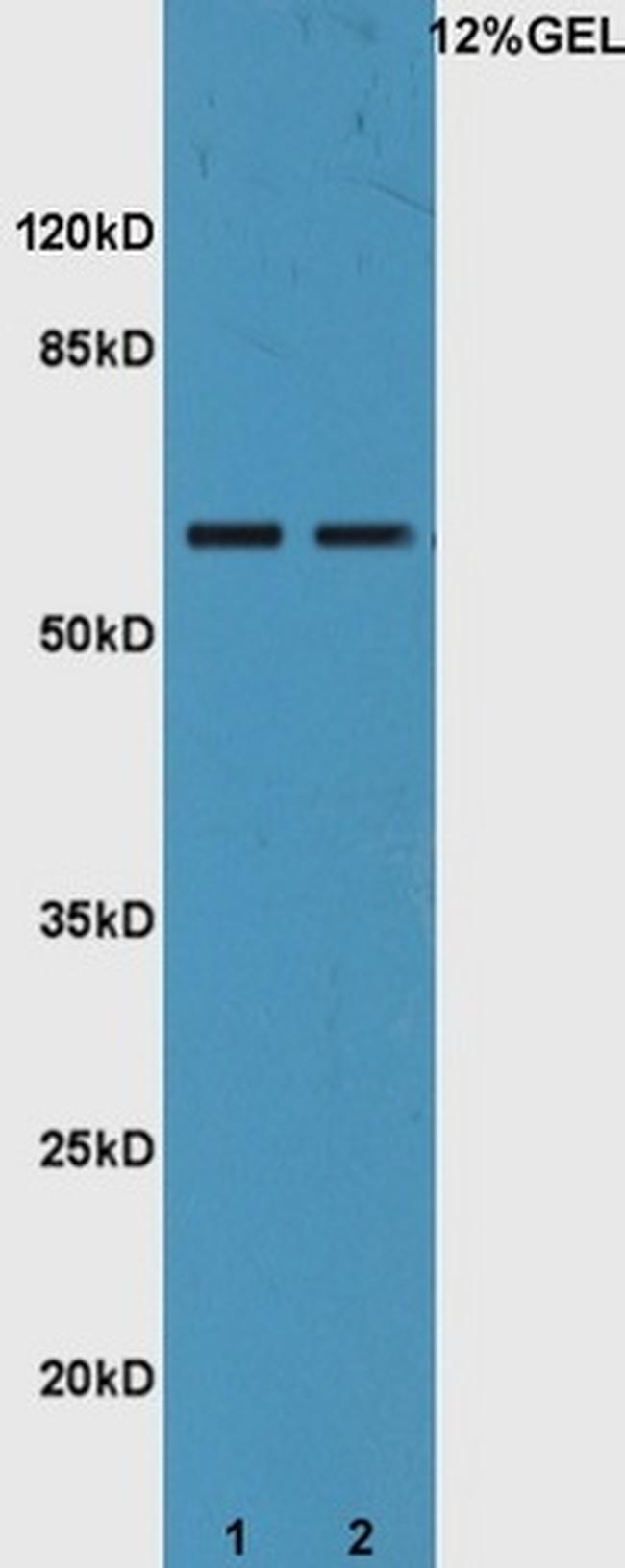 IL22RA1 Antibody in Western Blot (WB)