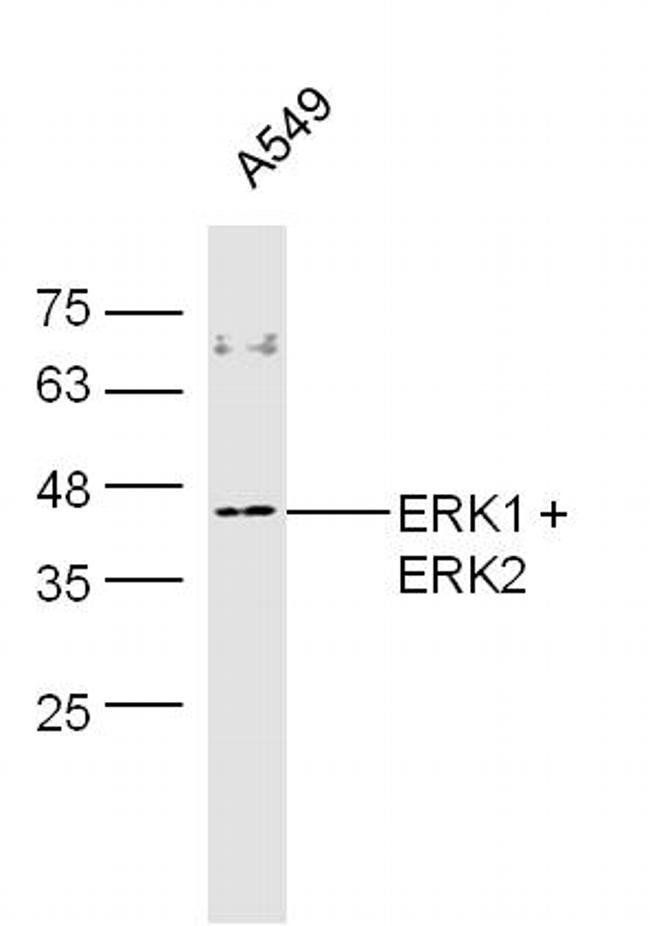 ERK1 + 2 Antibody in Western Blot (WB)