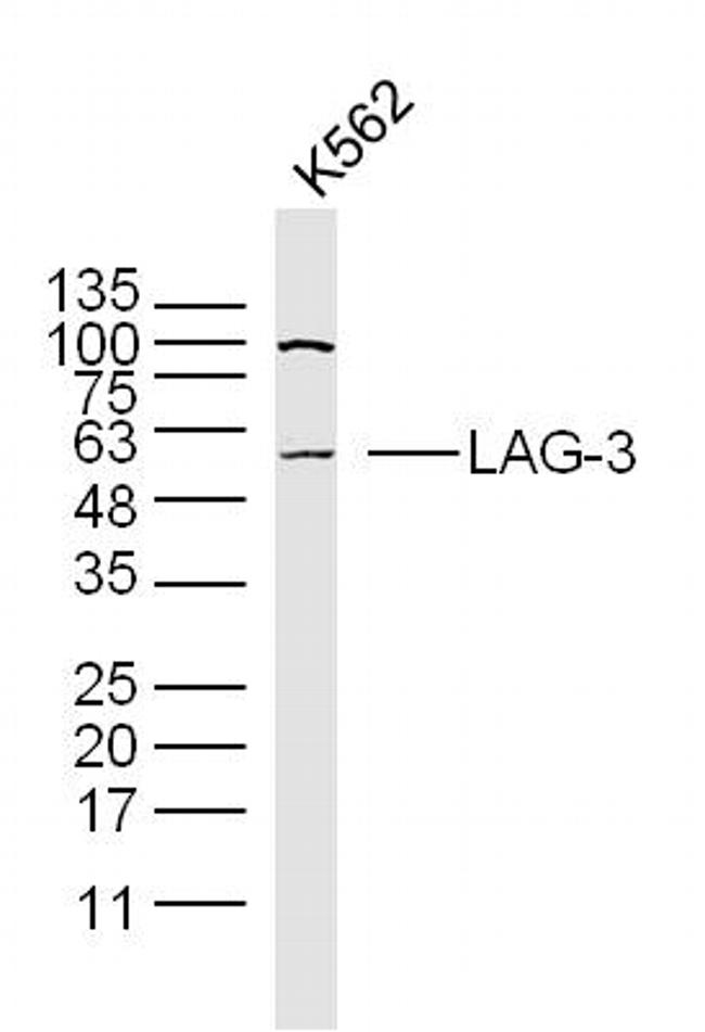 Lymphocyte Activation Gene 3 Antibody in Western Blot (WB)