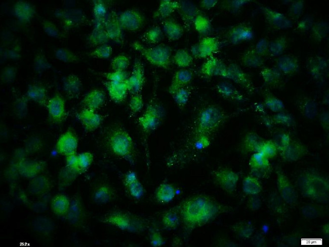 SPHK2 Antibody in Immunocytochemistry (ICC/IF)