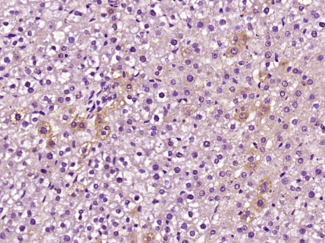 C5b-9 Antibody in Immunohistochemistry (Paraffin) (IHC (P))