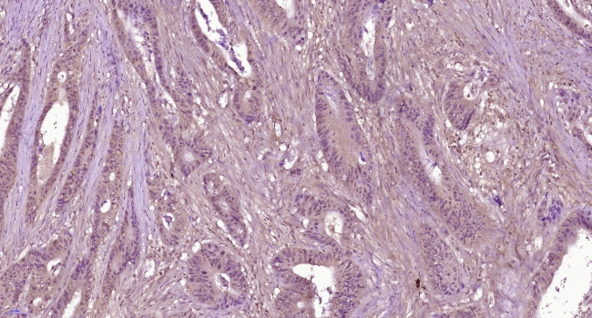 C5b-9 Antibody in Immunohistochemistry (Paraffin) (IHC (P))