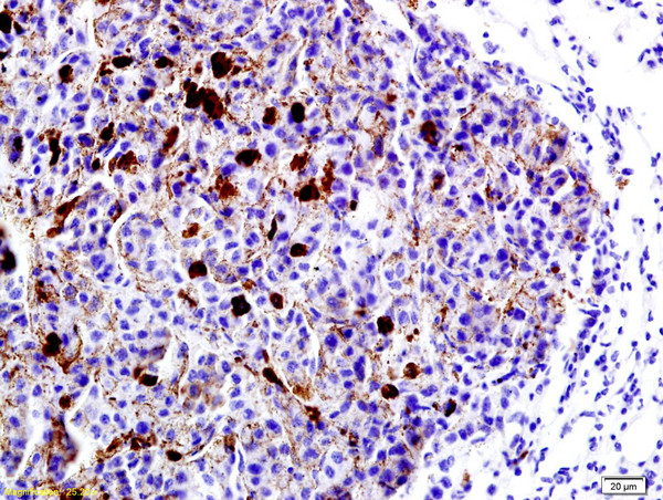 LRP1/CD91 Antibody in Immunohistochemistry (Paraffin) (IHC (P))