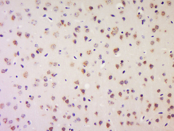 LRP1/CD91 Antibody in Immunohistochemistry (Paraffin) (IHC (P))