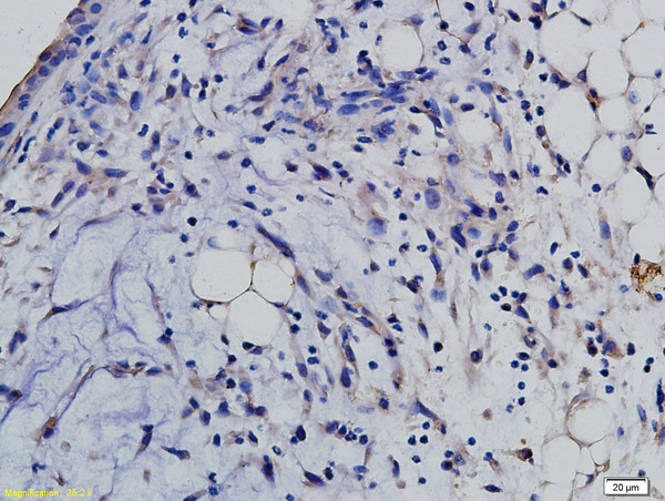 SLAMF6 Antibody in Immunohistochemistry (Paraffin) (IHC (P))