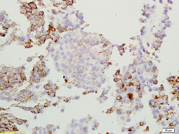 GPNMB Antibody in Immunohistochemistry (Paraffin) (IHC (P))