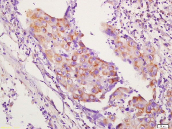 CD134 Antibody in Immunohistochemistry (Paraffin) (IHC (P))