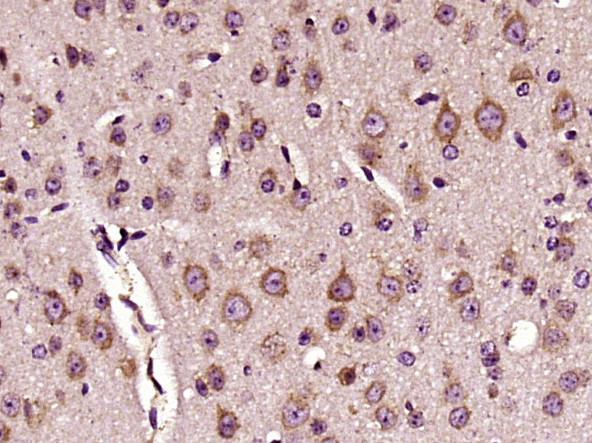 DKK3 Antibody in Immunohistochemistry (Paraffin) (IHC (P))