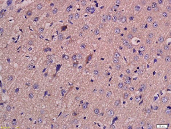 MCT4 Antibody in Immunohistochemistry (Paraffin) (IHC (P))