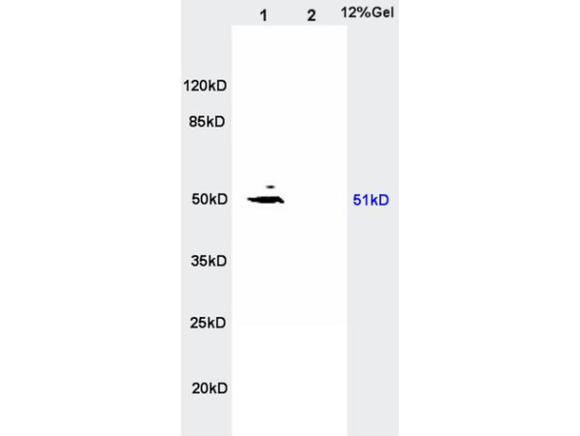 MCT4 Antibody in Western Blot (WB)