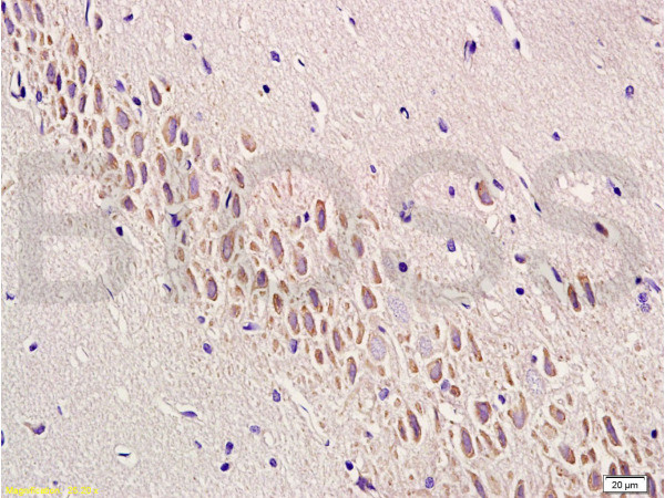 Semaphorin 7A Antibody in Immunohistochemistry (Paraffin) (IHC (P))