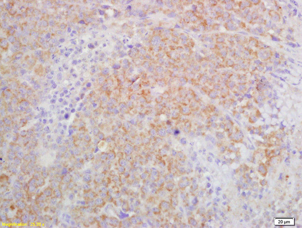 IL-27RA Antibody in Immunohistochemistry (Paraffin) (IHC (P))