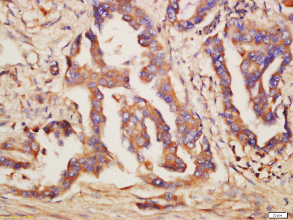 TLR6 Antibody in Immunohistochemistry (Paraffin) (IHC (P))