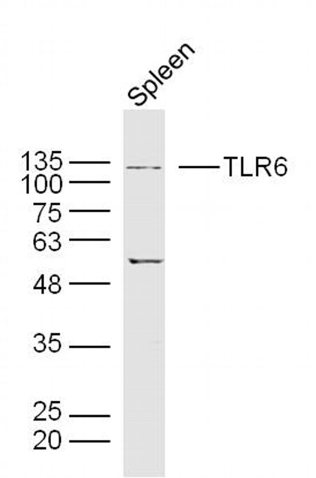 TLR6 Antibody in Western Blot (WB)