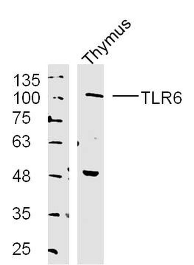 TLR6 Antibody in Western Blot (WB)