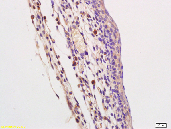 TLR9 Antibody in Immunohistochemistry (Paraffin) (IHC (P))